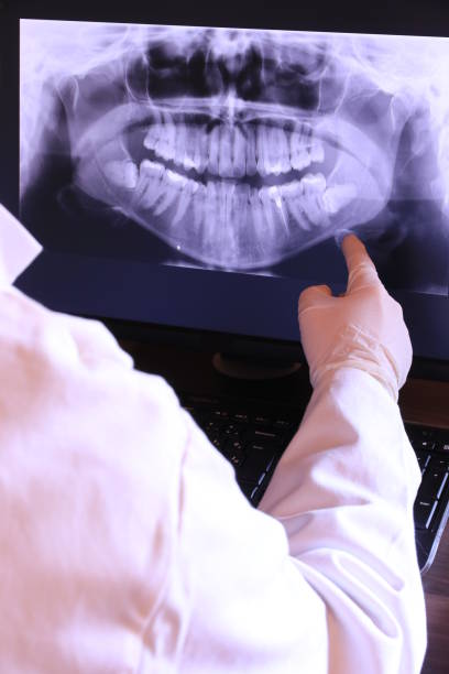 Best Emergency Treatment for Toothache in Mount Olive, IL