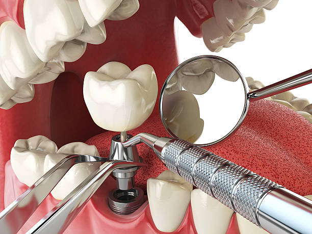 Best Pediatric Emergency Dentist in Mount Olive, IL